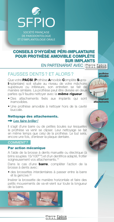 Fiche PFOC prothese